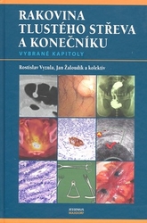 Vyzula, Rostislav; Žaloudík, Jan - Rakovina tlustého střeva a konečníku